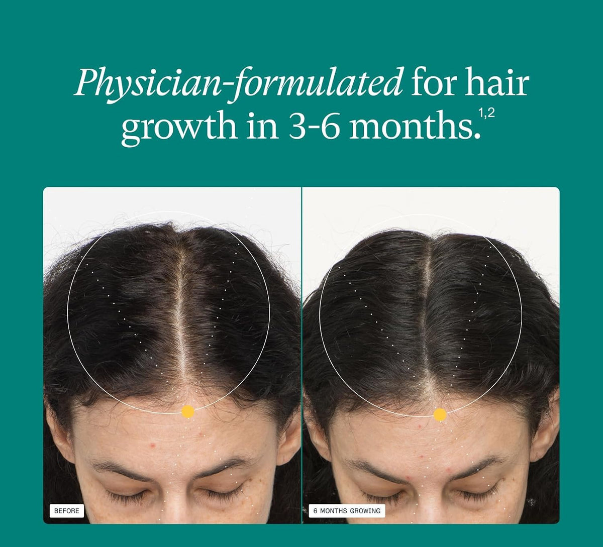 Women's Hair Growth Supplement for Thinning Hair, Ages 18-44, 120ct