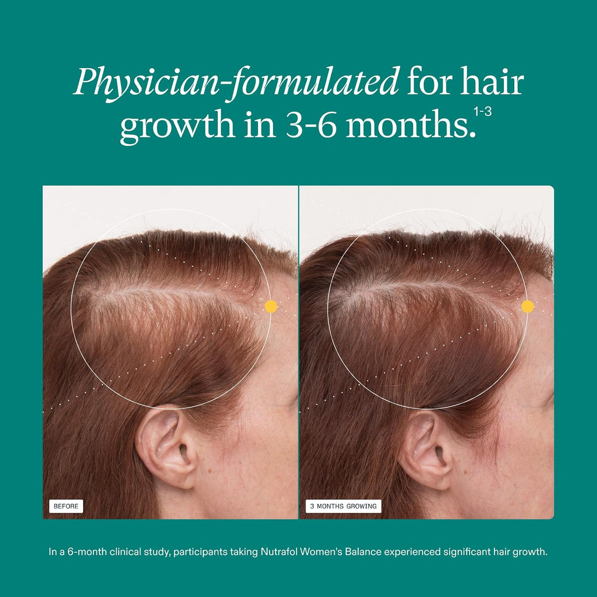 Women's Hair Growth Supplement for Menopause, Thinning Hair, 120ct