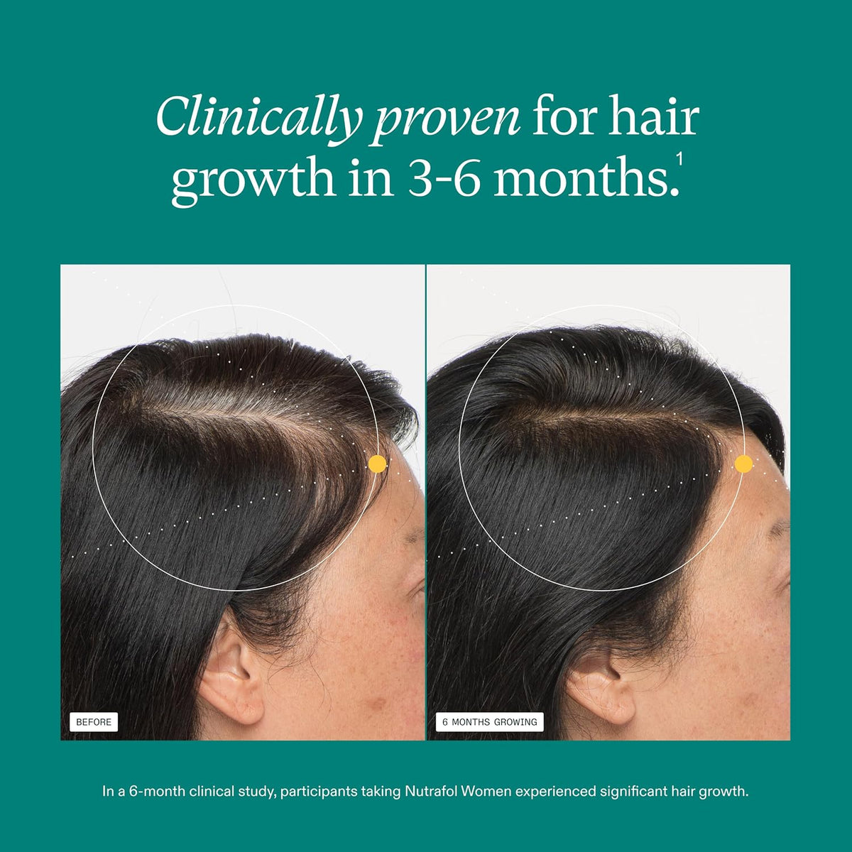 Women's Hair Growth Supplement 22-in-1, Hair Growth Ages 18-44 (Advance Formula)